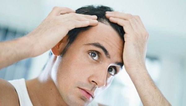 Peinados para hombres con poco pelo | Disimular las entradas
